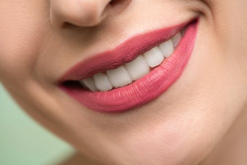 Why Teeth Whitening is Essential For Many People